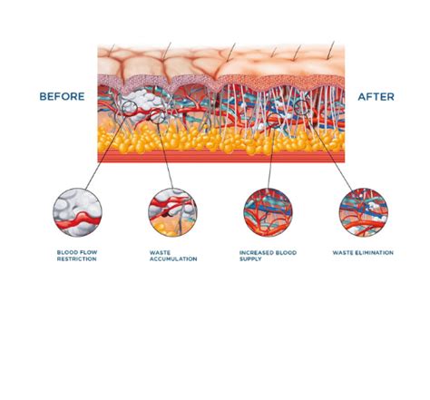 BTL Provider: Maryland Dermatology Laser Skin & Vein Institute.